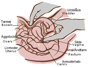 Bimanual Exam