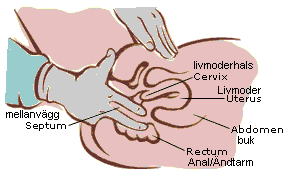 Rectovaginal Exam